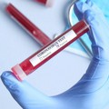 Coronavirus, 979 nuovi casi positivi e 21 decessi in Puglia