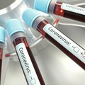 Coronavirus, in Puglia 1104 nuovi casi positivi: uno ogni 7 test