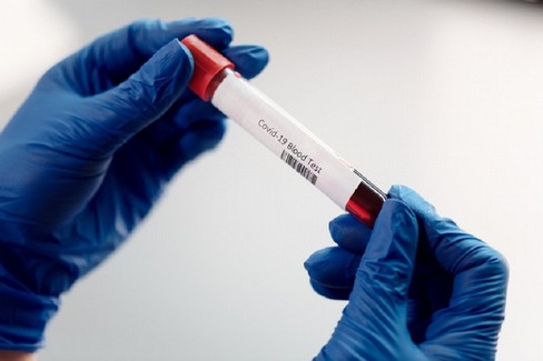Analisi di laboratorio (repertorio)